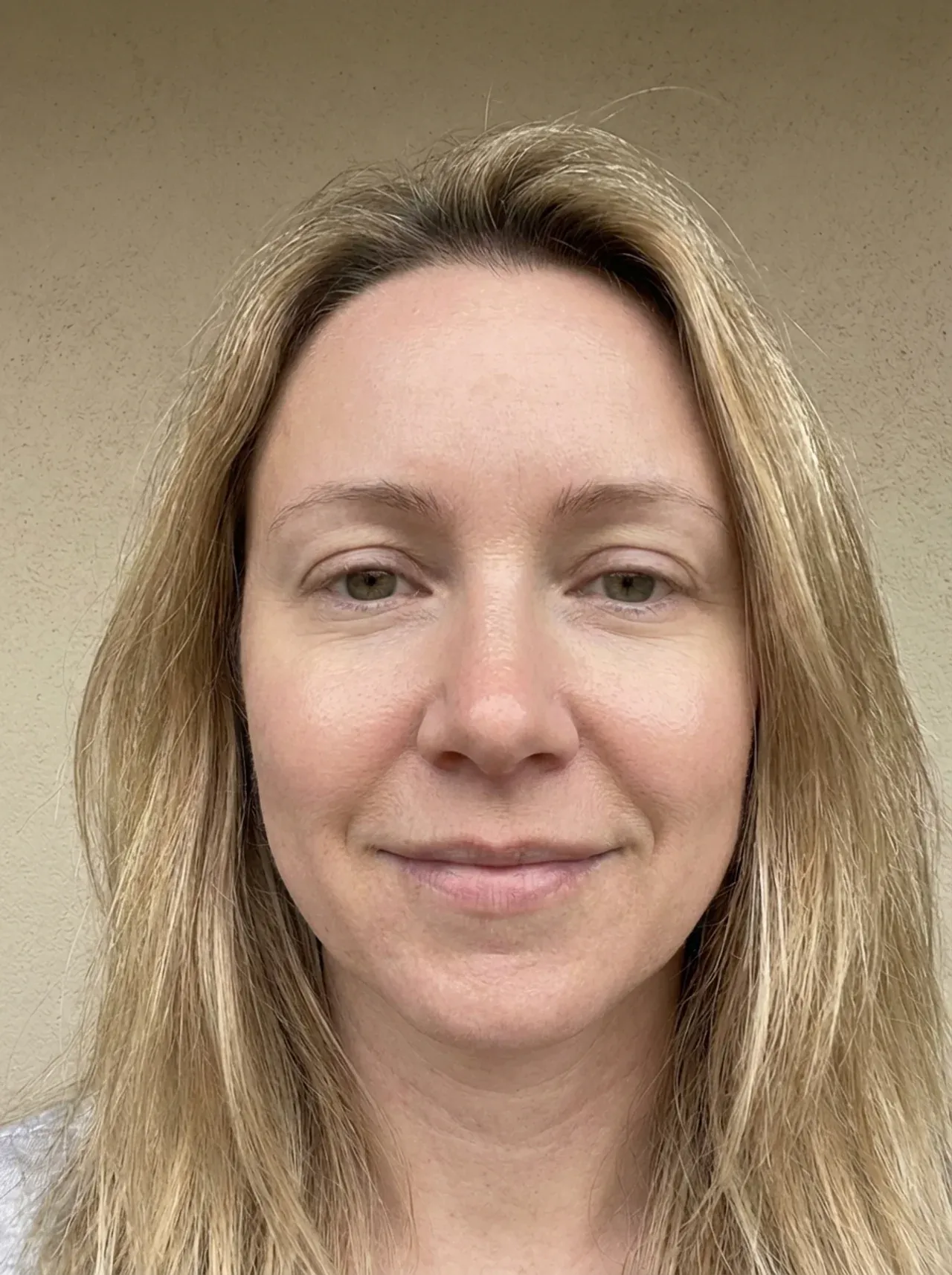 Radiant complexion with reduced redness after Talovia Tallow Honey Balm