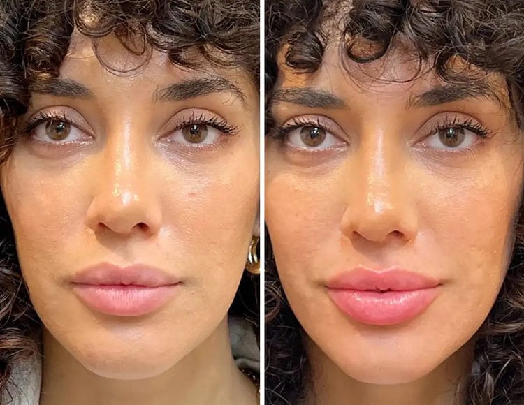 Glowvu 2-Step Lip Sculpt Ritual with hydrating serum and sculpting roller