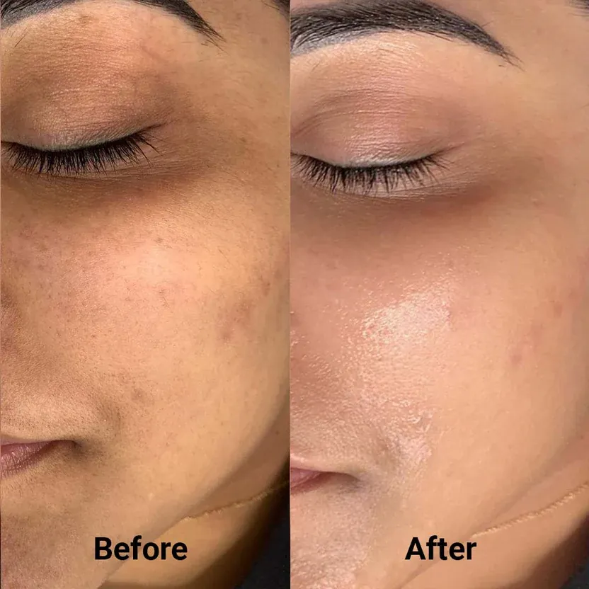 Aruabeauty Firming Expert Madeca Cream jar with Korean skincare clinic aesthetic