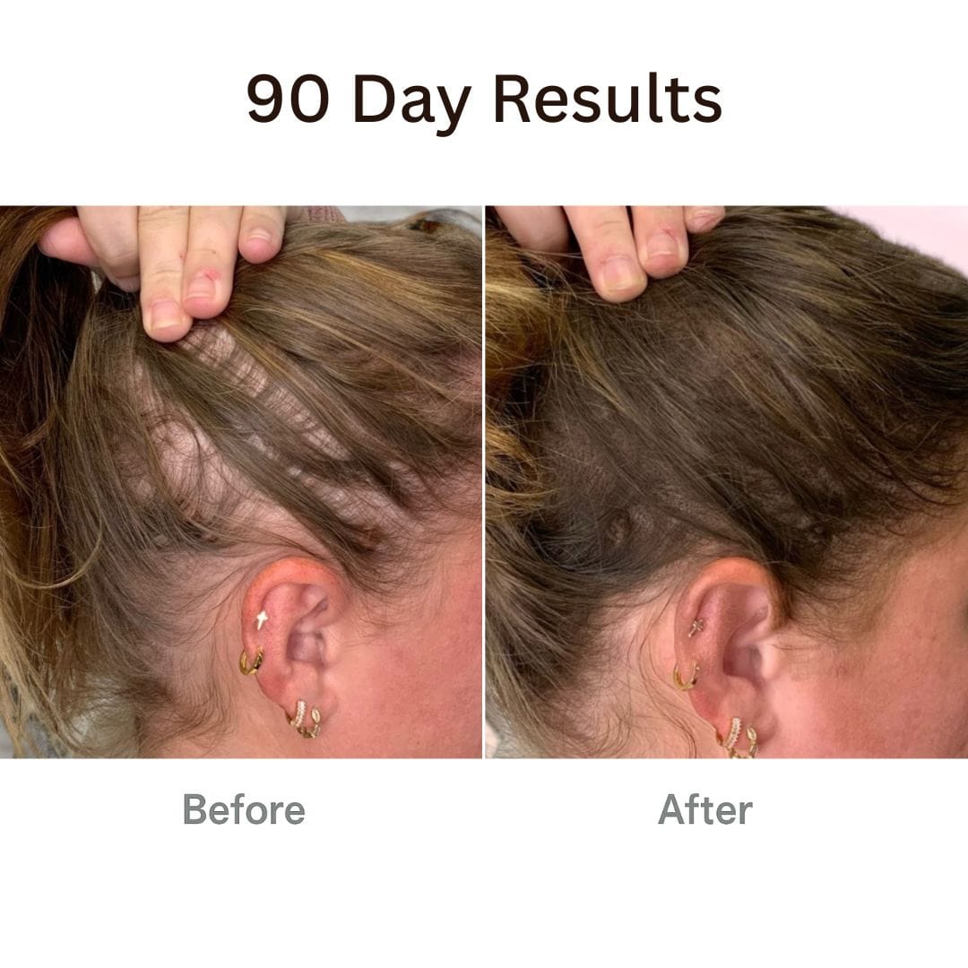 صورة لفرشاة نمو الشعر 4 في 1