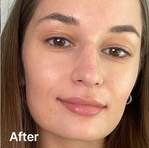 Femme avec une peau radieuse après utilisation du masque de nuit