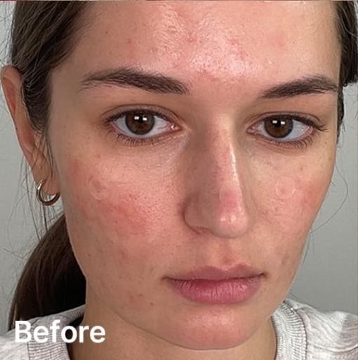 Femme avec une peau fatiguée avant utilisation du masque de nuit