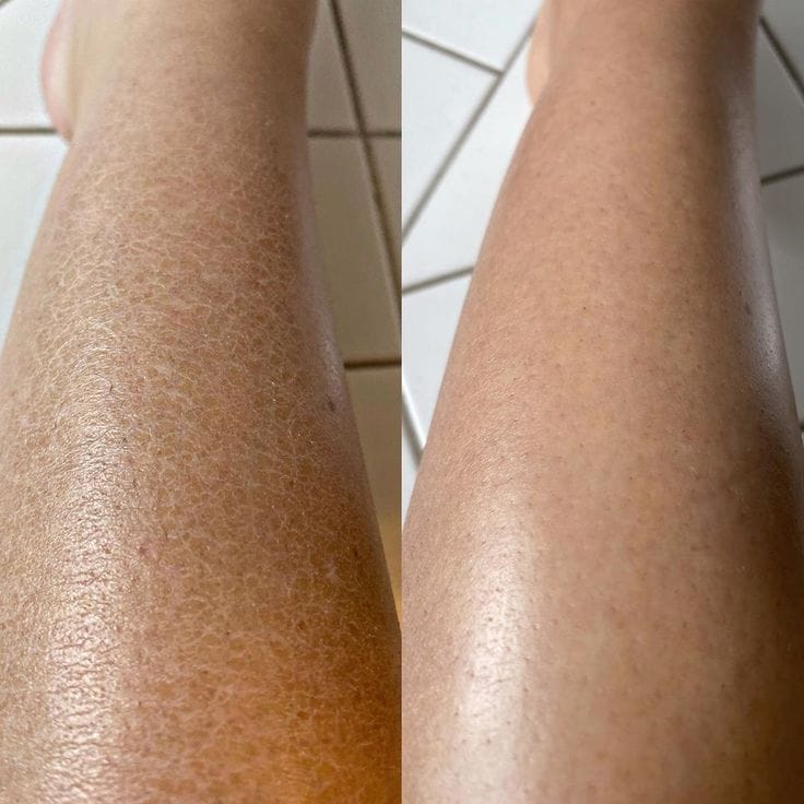 صورة لامرأة سعيدة تستعرض بشرتها الناعمة والمشرقة.