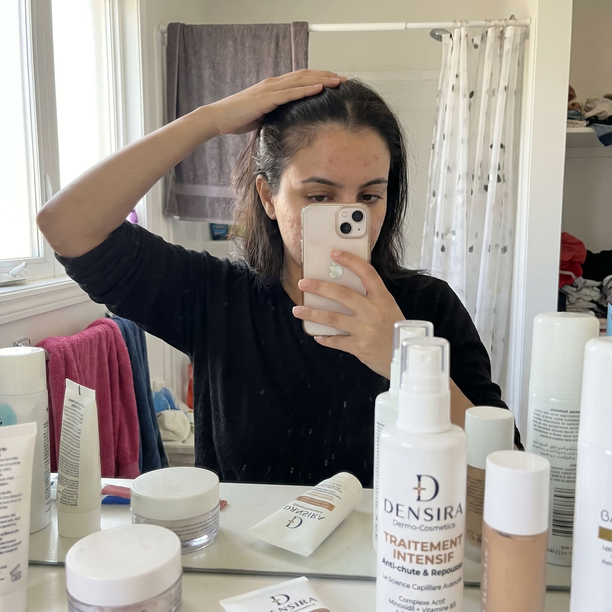 Après : Chevelure visiblement plus dense et saine