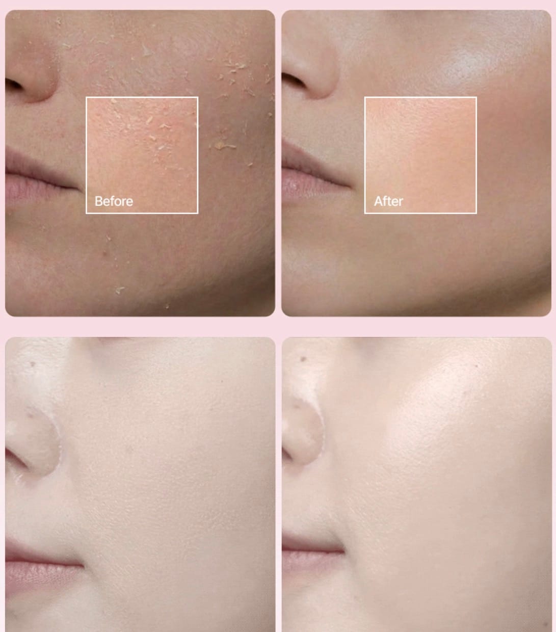 Skin before Glow Signature treatment