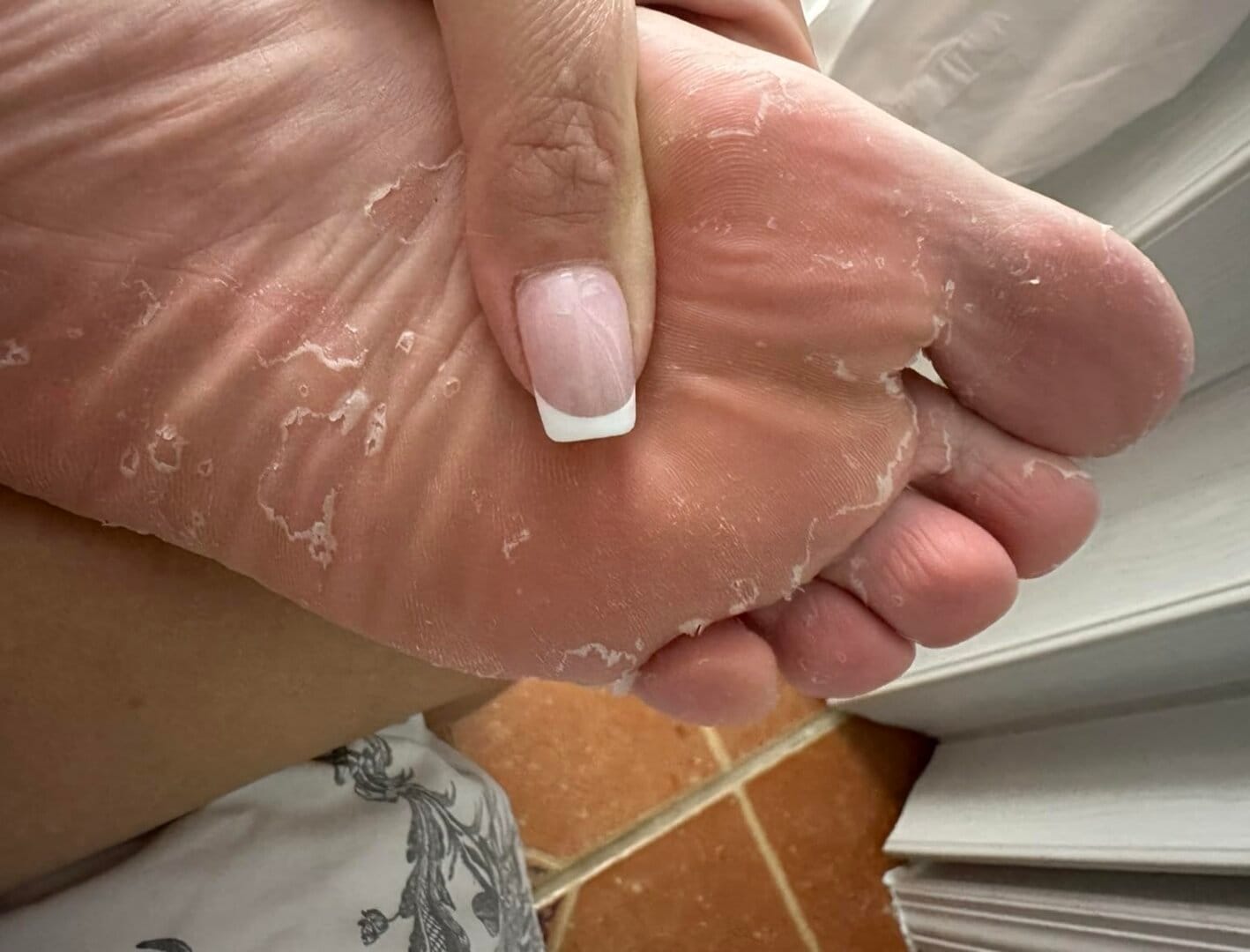 صورة قبل استخدام المنتج