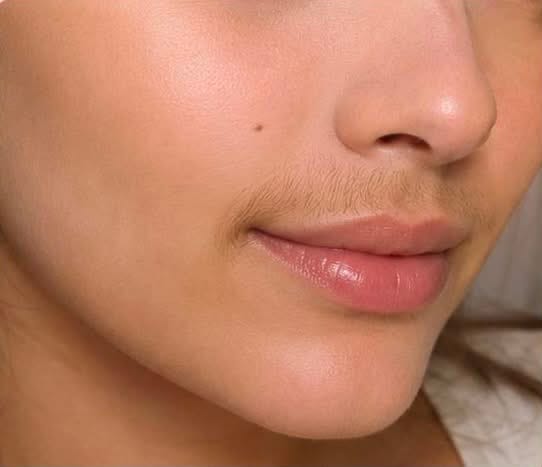 صورة قبل استخدام المنتج لإزالة الشعر