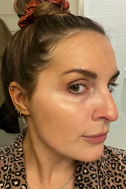 Image showing dull, dry skin before using the Luxora Beauty Glow Bundle