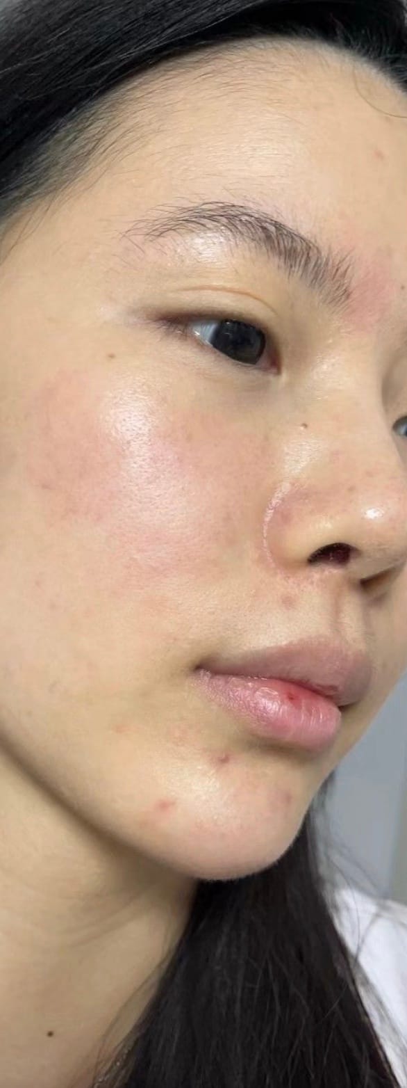 Close-up of dry skin texture