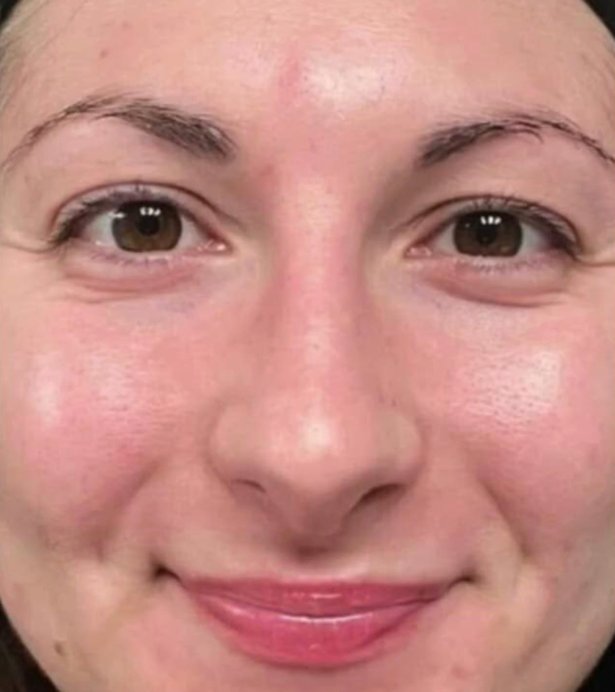 Radiant complexion after mask removal