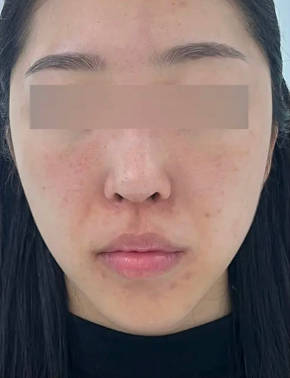 Dehydrated facial skin pre-application