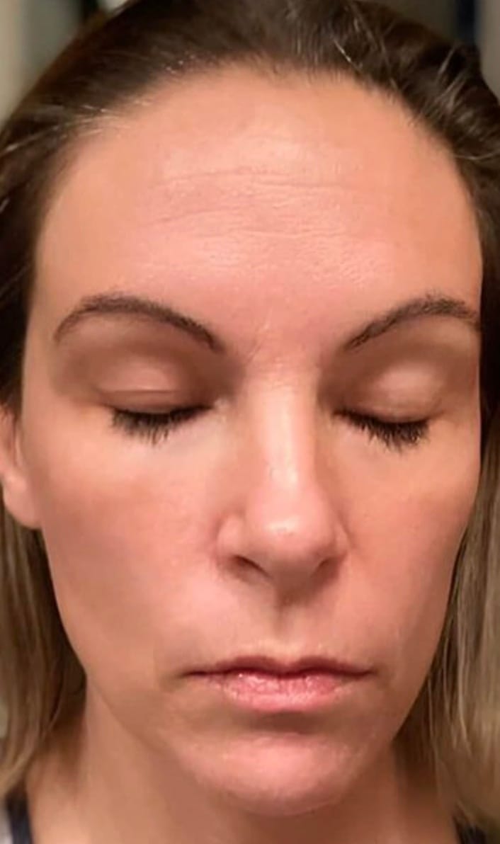 Smooth texture of skin post-mask