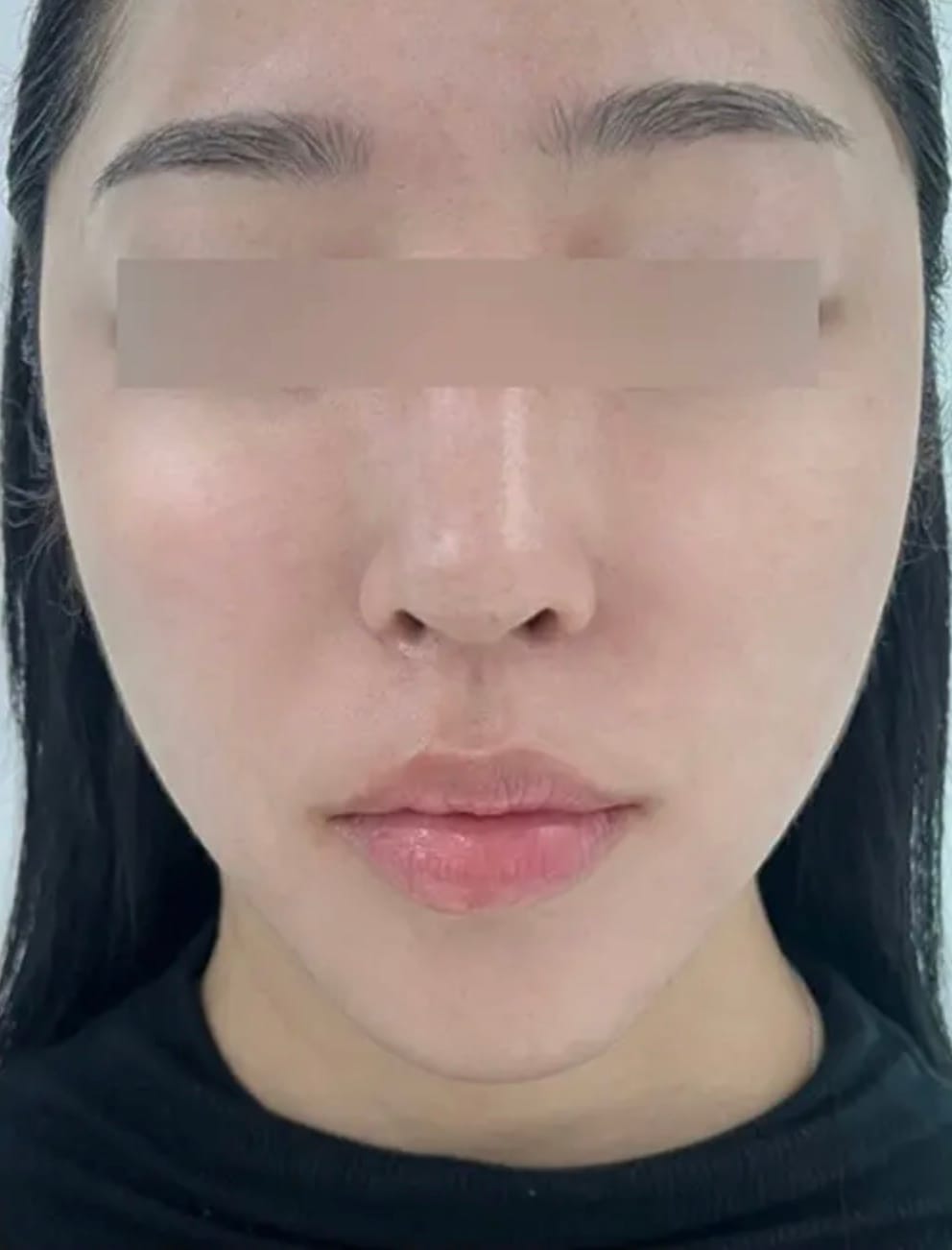 Hydrated facial skin after application