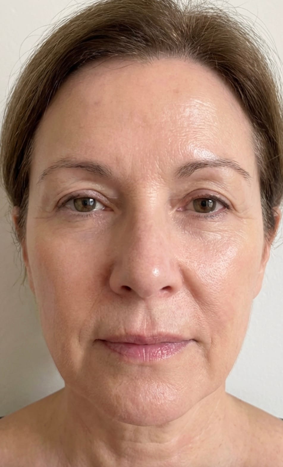 Woman with glowing skin after using LED mask