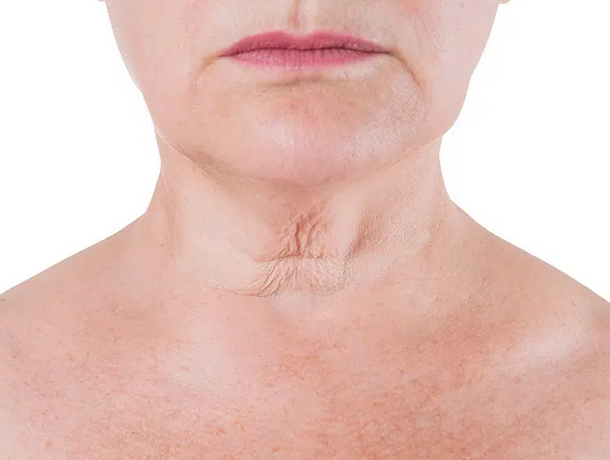 Skin showing signs of aging before using the eye and neck set
