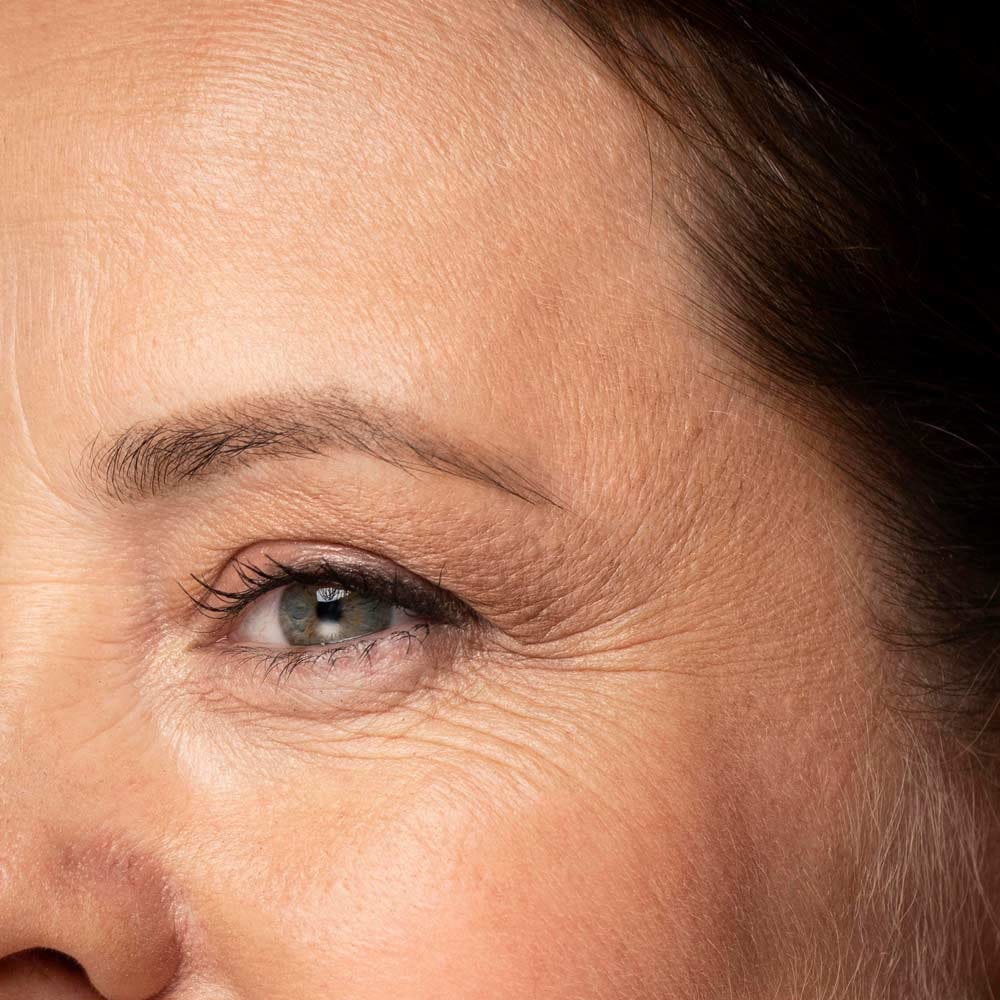 Anti-wrinkle eye cream effect