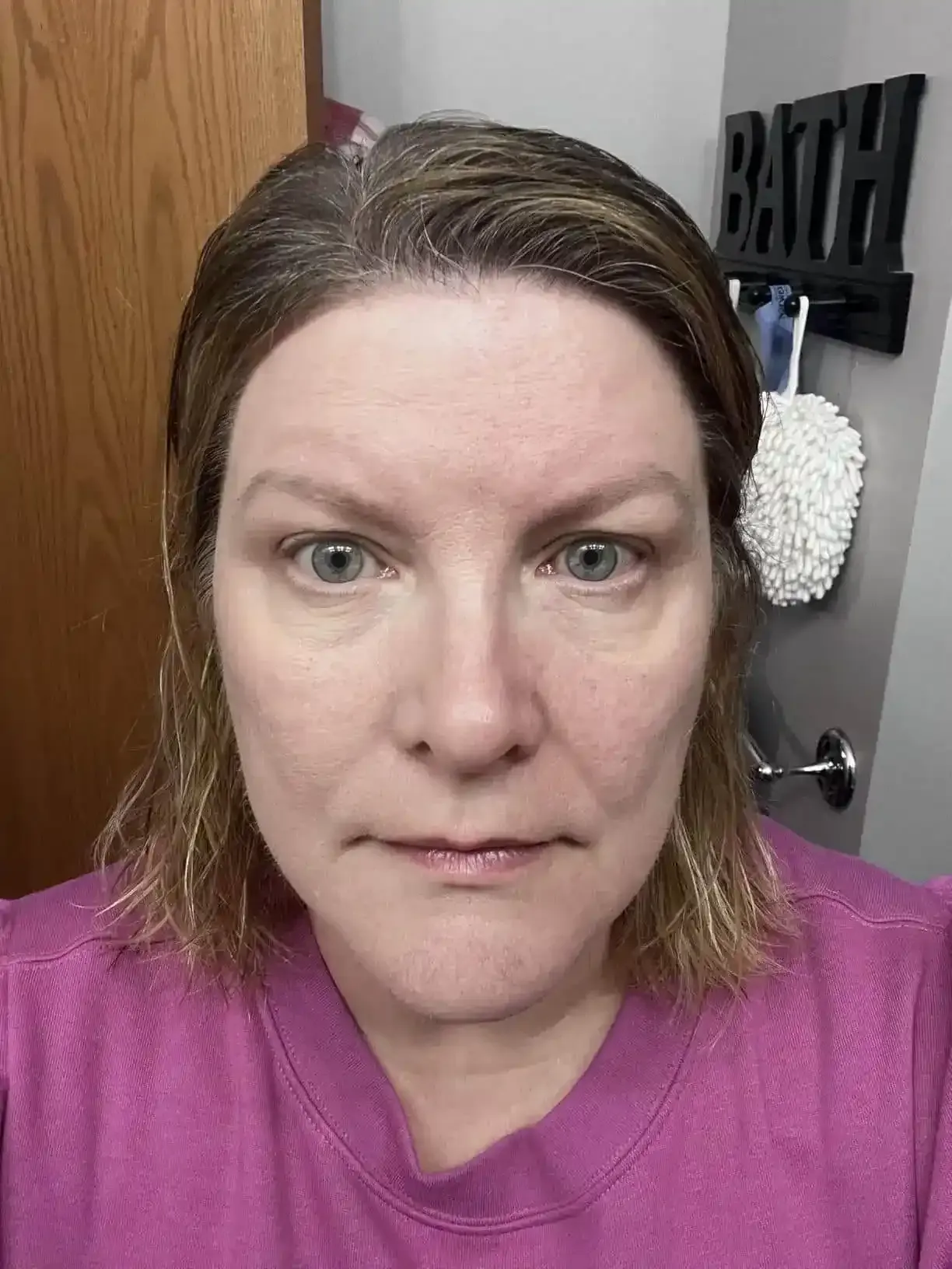 Woman with sensitive skin showing no redness after using TLM foundation