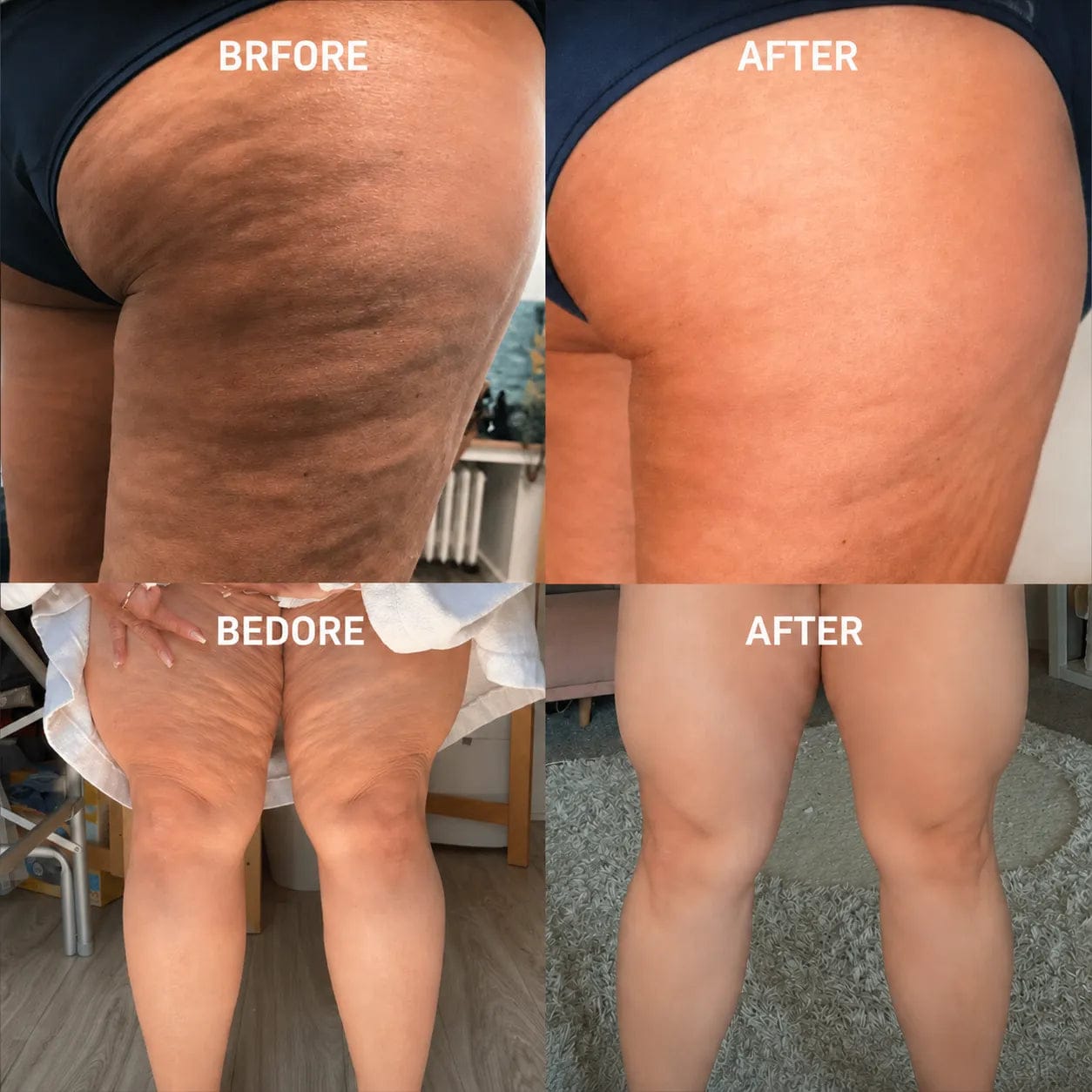 Gold infused firming gel for body contouring