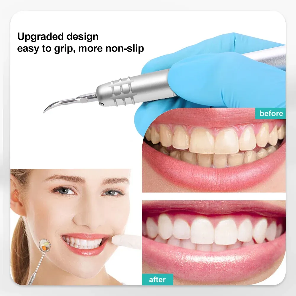 Ultrasonic dental scaler being held comfortably by a professional dentist