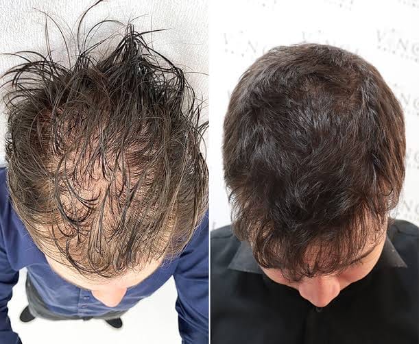 Sérum densifiant pour cheveux plats