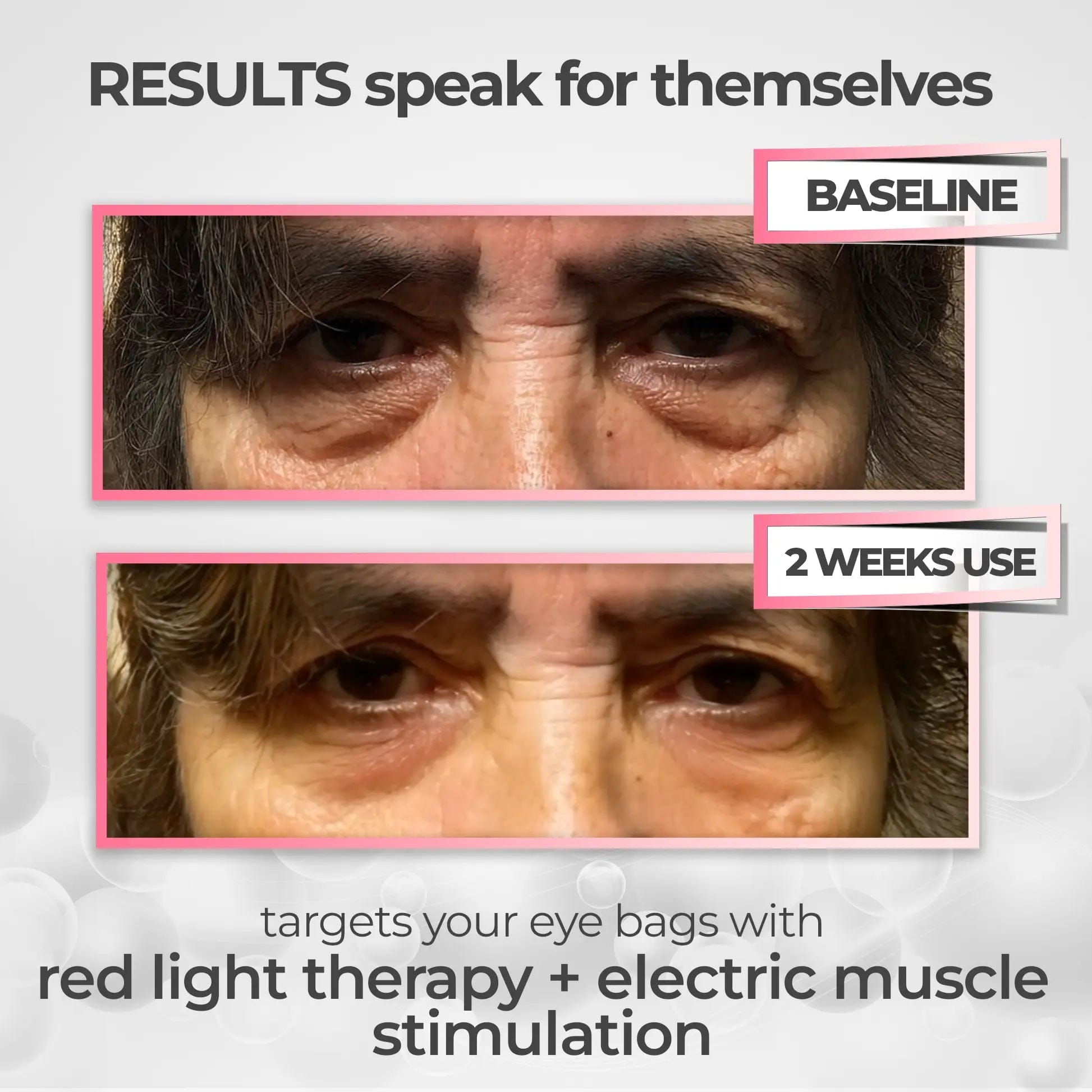 Lymphatic drainage technology in action