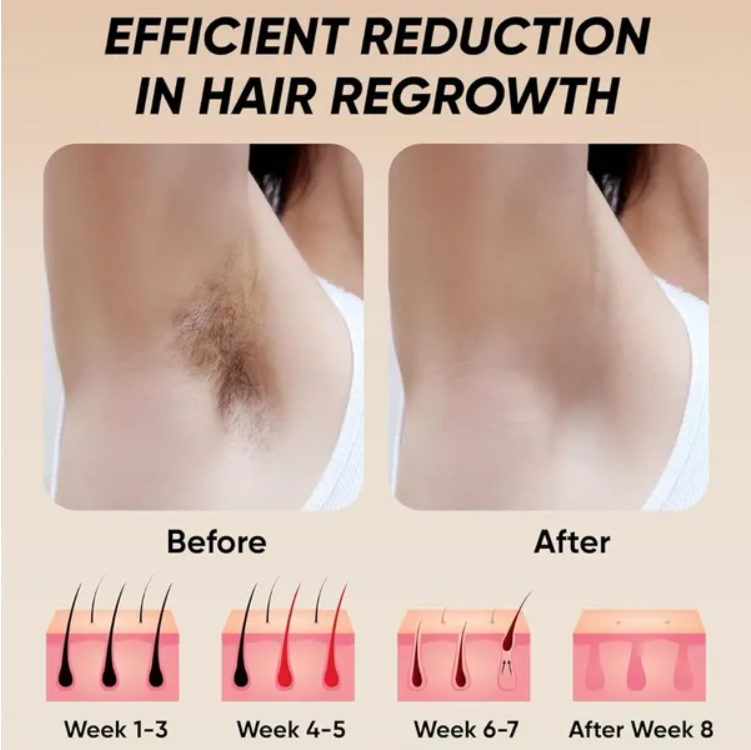 Smooth skin after IPL treatment
