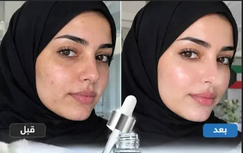 سيروم النحاس والببتيدات لشد وتجديد البشرة